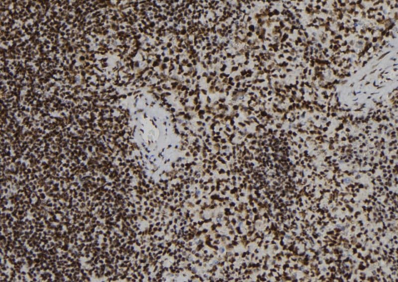 ADAP / FYB Antibody