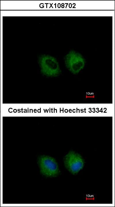 Polyclonal Rabbit anti-Human CD121b / IL1R2 Antibody (aa172-398, IHC, WB)