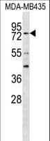 RFX3 Antibody (aa661-690)