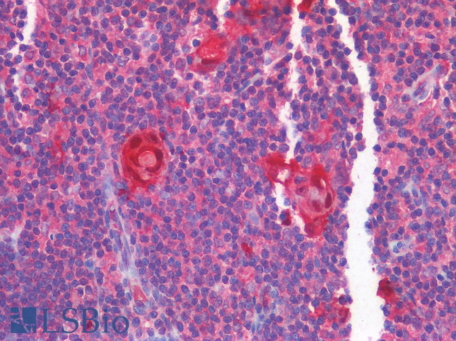IHC-plus™ Polyclonal Rabbit anti-Human TP53 / p53 Antibody (IHC)