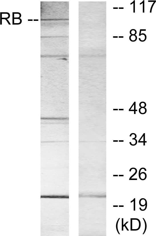 IHC-plus™ Polyclonal Rabbit anti-Human RB1 / Retinoblastoma / RB Antibody (aa781-830, IHC, WB)