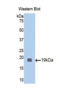 Polyclonal Rabbit anti-Human UGCG Antibody (FITC, aa39-171, WB)