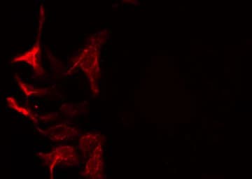Polyclonal Rabbit anti-Human COPZ1 Antibody (IHC, IF, WB)