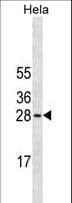 COMT Antibody (aa37-65)