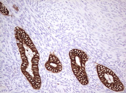 Basic Cytokeratin AE3 Antibody (clone AE3)