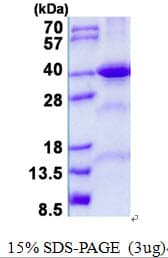Human FBP2 Protein (Recombinant His)