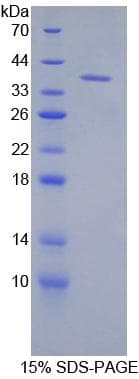 Mouse KRT71 / Keratin 71 Protein (Recombinant His)