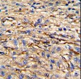 NES / Nestin Antibody (Ser1409)