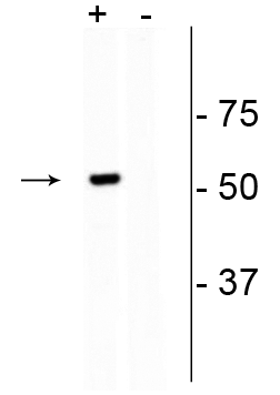 Streptococcus pyogenes CRISPR-associated endonuclease Cas9/Csn1 Antibody (C-term, clone 6F7)