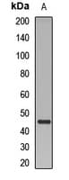 ARRB2 / Beta Arrestin 2 Antibody
