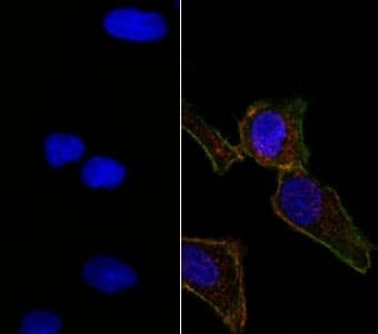 EPCAM Antibody (aa20-60, clone EGP40/826)