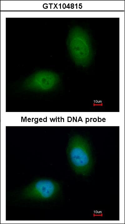 IHC-plus™ HSPB8 / H11 / HSP22 Antibody (aa134-196)