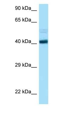CCNB2 / Cyclin B2 Antibody (C-Terminus)