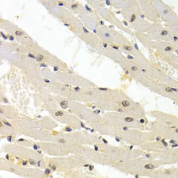 MURF1 / IRF Antibody