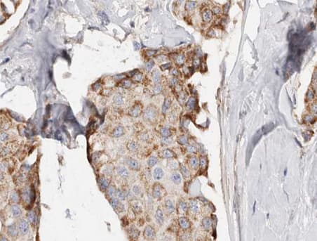 Polyclonal Rabbit anti-Human PHLDA2 / TSSC3 Antibody (IHC, WB)