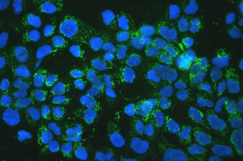 Polyclonal Rabbit anti-Human MtTFA / TFAM Antibody (IHC, WB)