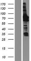 GGA1 Protein (Over-Expression Lysate Myc-DDK (Flag))