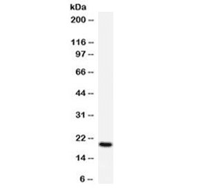 APRT Antibody (aa5-49)
