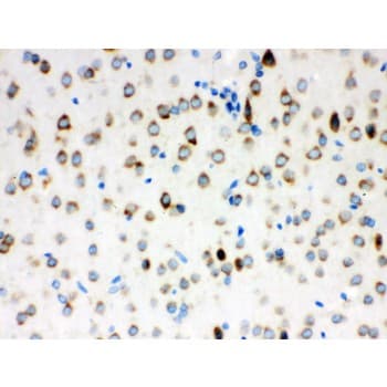 Polyclonal Rabbit anti-Human ATXN2 / SCA2 / Ataxin-2 Antibody (aa1283-1313, IHC, WB)