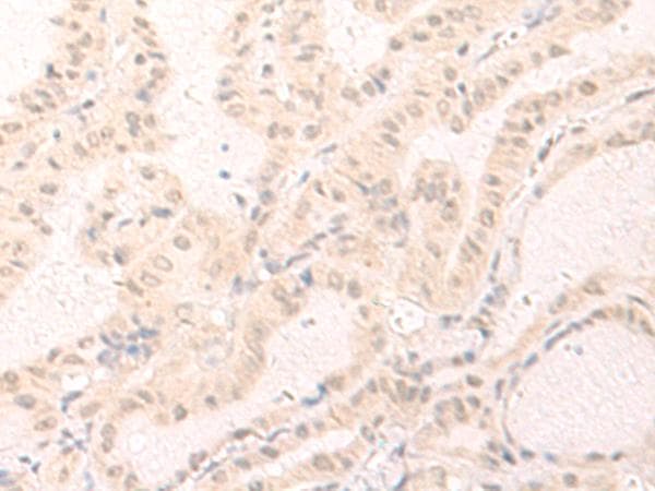 IL7 Antibody