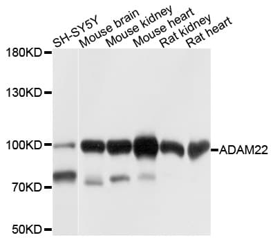 ADAM22 Antibody