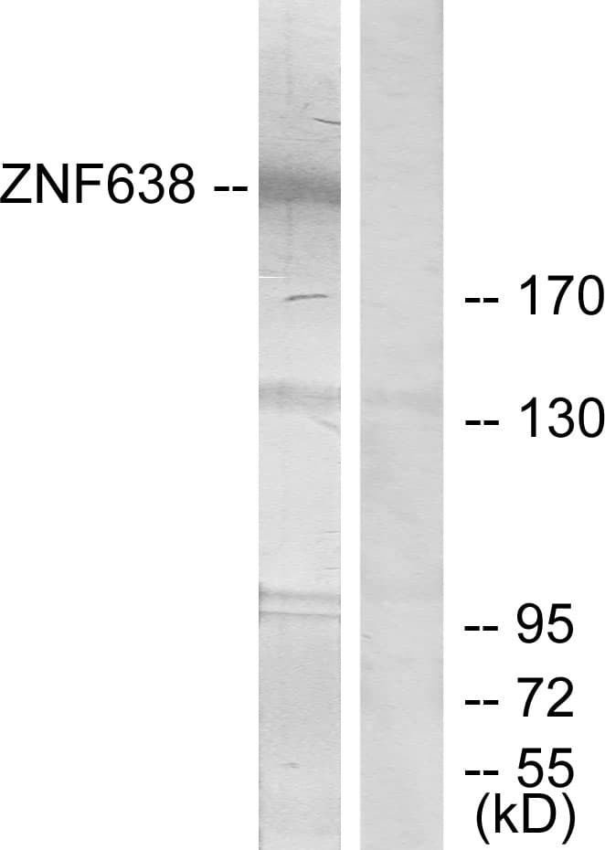 ZNF638 Antibody (aa1271-1320)