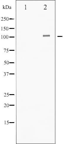 HDAC4 Antibody (phospho-Ser632)