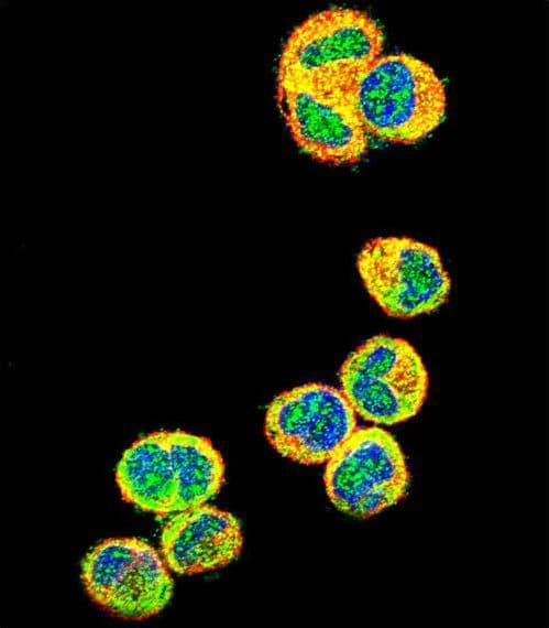Polyclonal Rabbit anti-Human AKT1 Antibody (aa115-144, IHC, IF, WB)