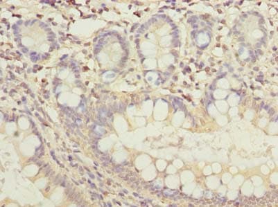 FAM118B Antibody