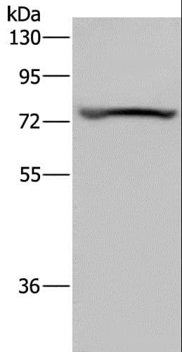 KCNQ1 / KVLQT1 Antibody