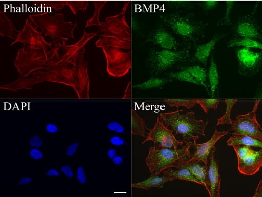 BMP4 Antibody (aa293-408, clone UMAB42)