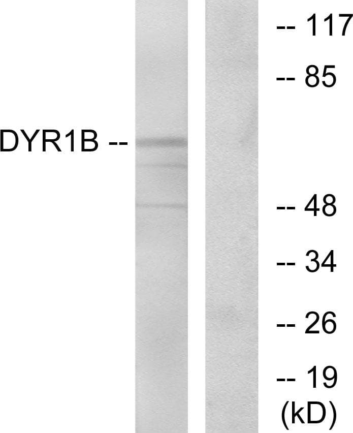 DYRK1B Antibody