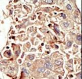Polyclonal Rabbit anti-Human ALK2 / ACVR1 Antibody (aa132-162, IHC, WB)