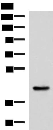 Polyclonal Rabbit anti-Human HPN / TMPRSS1 / Hepsin Antibody (WB)