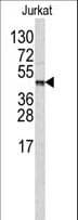 CPB2 / TAFI Antibody (aa119-148)