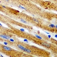 Polyclonal Rabbit anti-Human CAPN1 / Calpain 1 Antibody (IHC, WB)