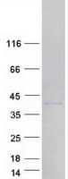Human HNRNPA1L2 Protein (Recombinant Myc-DDK (Flag))