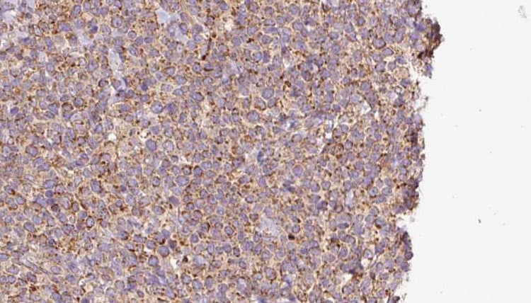 AP2A1 / AP2-Alpha Antibody