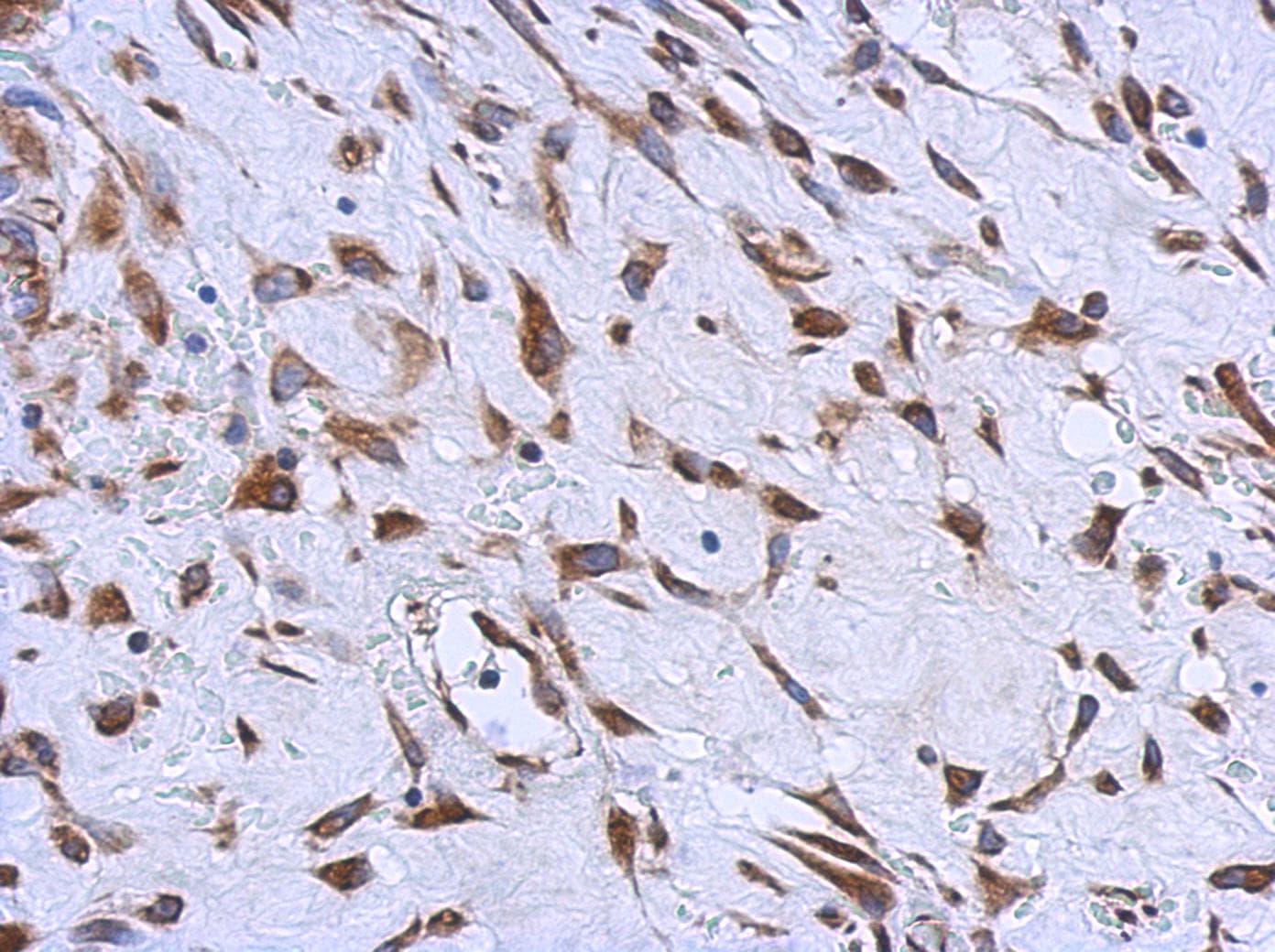 MMACHC Antibody (aa1-218)
