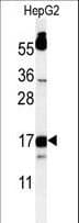 IHC-plus™ DAP12 Antibody (aa85-113)