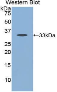 CTSK / Cathepsin K Antibody (aa54-317)