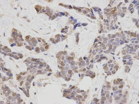 PLCB1 / Phospholipase C Beta 1 Antibody