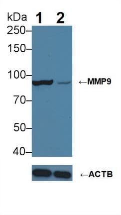 Monoclonal Mouse anti-Human MMP9 / Gelatinase B Antibody (aa213-399, WB)
