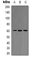 Polyclonal Rabbit anti-Human AKT2 Antibody (C-Terminus, IHC, WB)