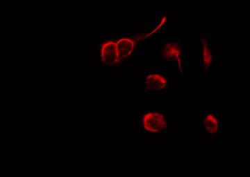 NRG1 / Heregulin / Neuregulin Antibody