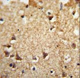 Polyclonal Rabbit anti-Human EIF2A / EIF2 Alpha Antibody (aa437-465, IHC, WB)
