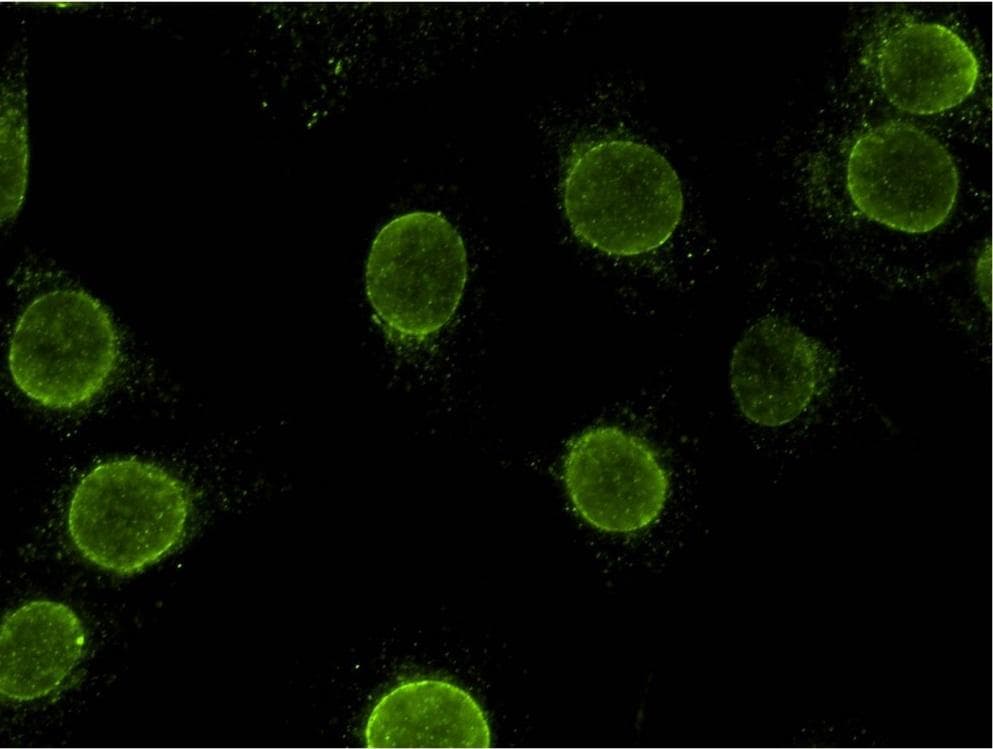 SYNE3 / C14orf49 Antibody