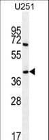 PRR16 Antibody (aa182-210)