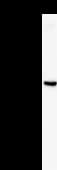 TARS Antibody (clone TARSF8H3)