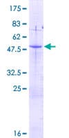Human AKIP1 / BCA3 Protein (Recombinant GST)